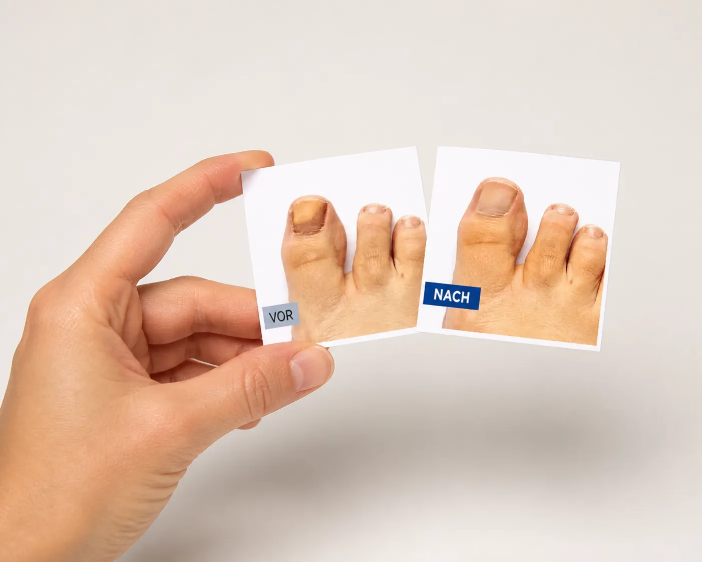 EXODERMIN EU — Verpackung in der Hand